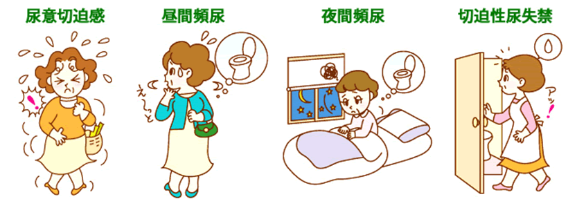 過活動膀胱のよくある症状